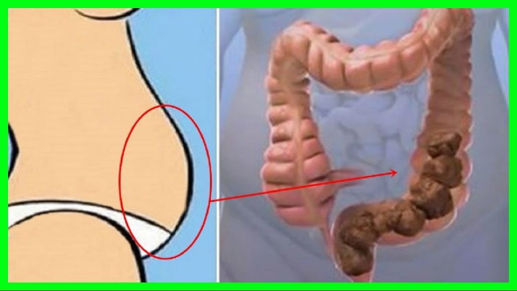 eliminar 10 kg de esa caca atascada