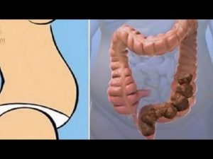 eliminar 10 kg de esa caca atascada 