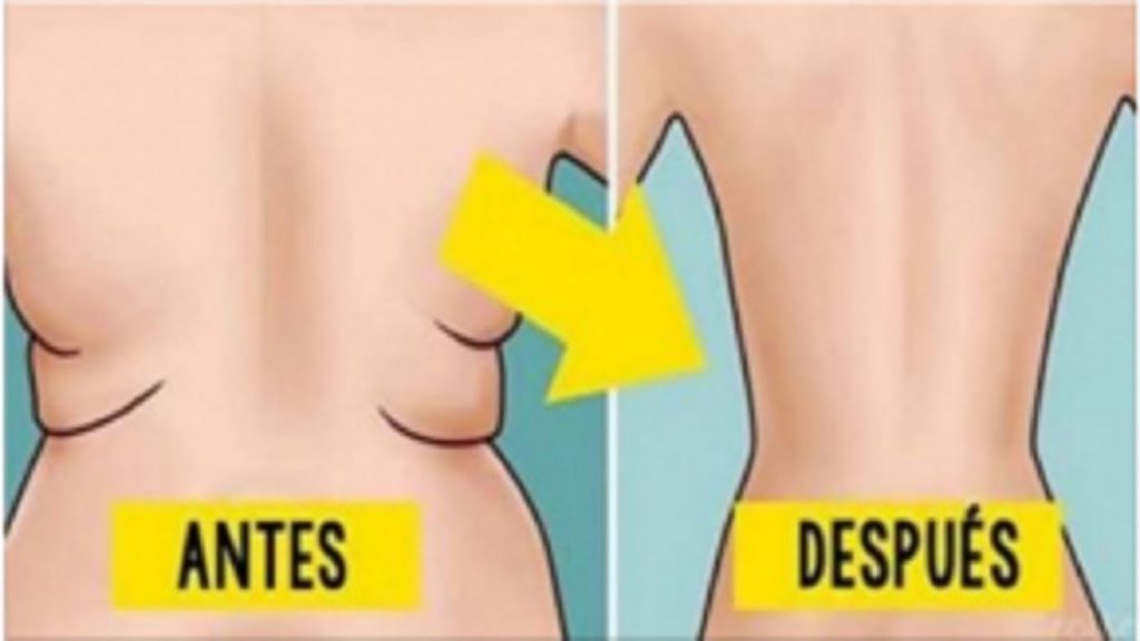 eliminar los gorditos de la espalda